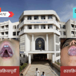 दुभंगलेले-ओठ-व-टाळूच्या-रुग्णांसाठी-मोफत-शस्त्रक्रिया-शिबिराचे-आयोजन.png