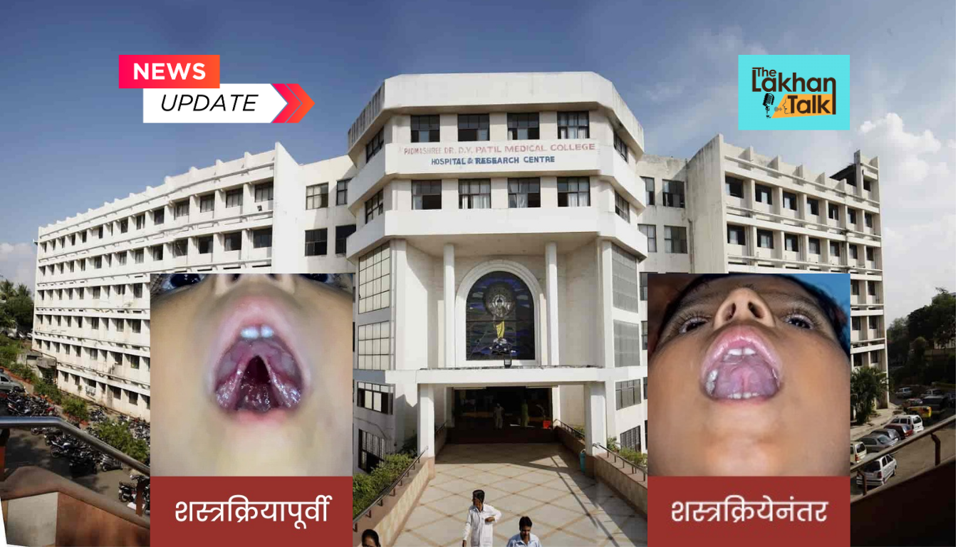 दुभंगलेले-ओठ-व-टाळूच्या-रुग्णांसाठी-मोफत-शस्त्रक्रिया-शिबिराचे-आयोजन.png